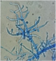Figure 2 (microscopie de Trichoderma longibrachiatum)